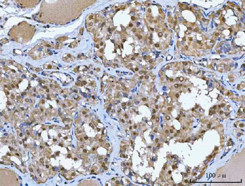 Glutathione Reductase/GSR Rabbit Polyclonal Antibody