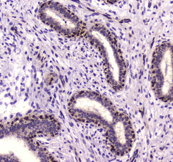 NFIB/NF1B2 Rabbit Polyclonal Antibody