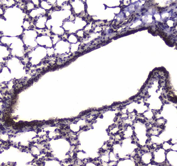 NFIB/NF1B2 Rabbit Polyclonal Antibody