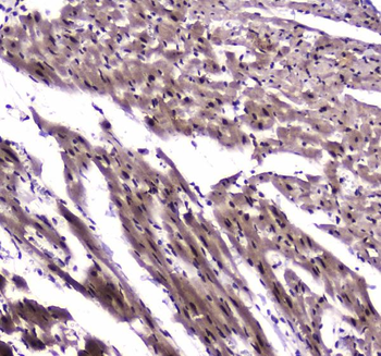 NFIB/NF1B2 Rabbit Polyclonal Antibody