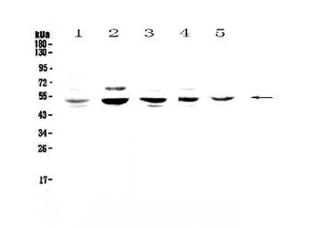 NFIB/NF1B2 Rabbit Polyclonal Antibody
