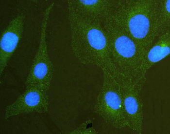 SCRIBBLE Rabbit Polyclonal Antibody