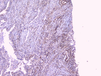 PBP/PEBP1 Antibody