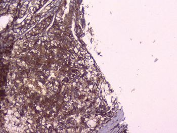 PBP/PEBP1 Antibody