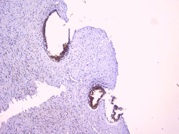 PBP/PEBP1 Antibody