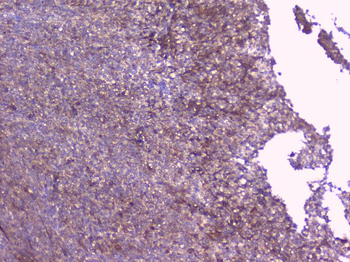 PBP/PEBP1 Antibody