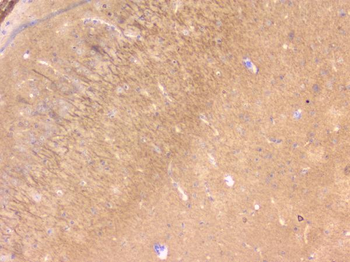 PBP/PEBP1 Antibody