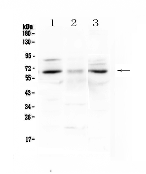 CCKBR Rabbit Polyclonal Antibody