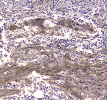 Creatine kinase B type/CKB Rabbit Polyclonal Antibody