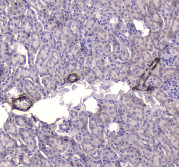 Creatine kinase B type/CKB Rabbit Polyclonal Antibody