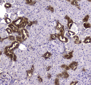 Creatine kinase B type/CKB Rabbit Polyclonal Antibody