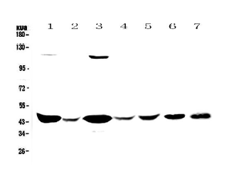 Creatine kinase B type/CKB Rabbit Polyclonal Antibody