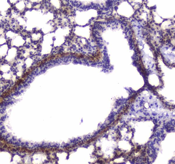 Myosin light chain kinase/MYLK Rabbit Polyclonal Antibody
