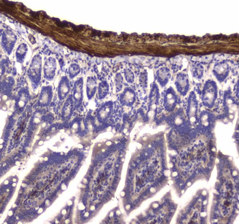 Myosin light chain kinase/MYLK Rabbit Polyclonal Antibody