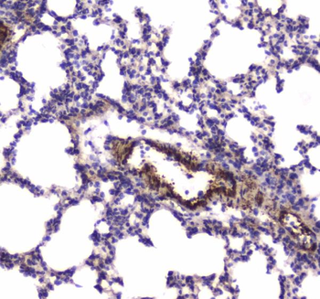 Myosin light chain kinase/MYLK Rabbit Polyclonal Antibody