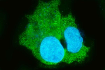 Liver Carboxylesterase 1/CES1 Rabbit Polyclonal Antibody