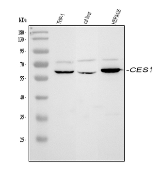 Liver Carboxylesterase 1/CES1 Rabbit Polyclonal Antibody