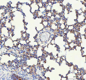 VE-Cadherin Cdh5-/VE Rabbit Polyclonal Antibody