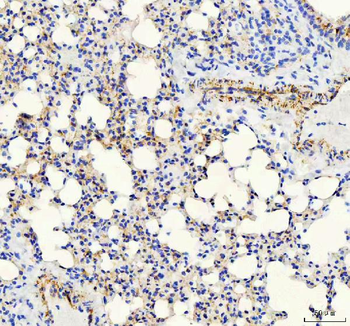 VE-Cadherin Cdh5-/VE Rabbit Polyclonal Antibody