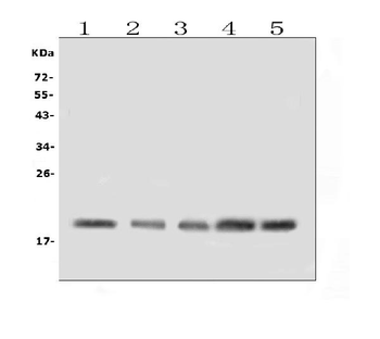 BAFF Receptor/TNFRSF13C Rabbit Polyclonal Antibody
