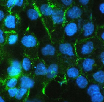beta Catenin CTNNB1 Antibody (monoclonal, 1F6)