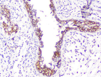 beta Catenin CTNNB1 Antibody (monoclonal, 1F6)