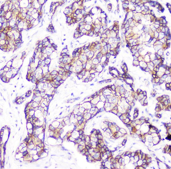 beta Catenin CTNNB1 Antibody (monoclonal, 1F6)