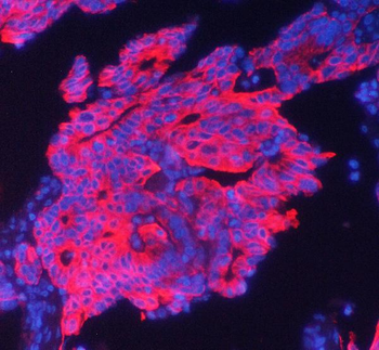 Cytokeratin 19 KRT19 Mouse Monoclonal Antibody