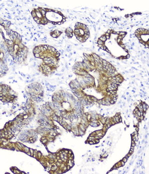 Cytokeratin 19 KRT19 Mouse Monoclonal Antibody