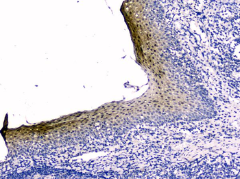 Stefin B CSTB Mouse Monoclonal Antibody