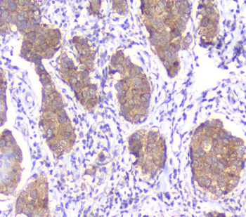 SMN1/2 Mouse Monoclonal Antibody
