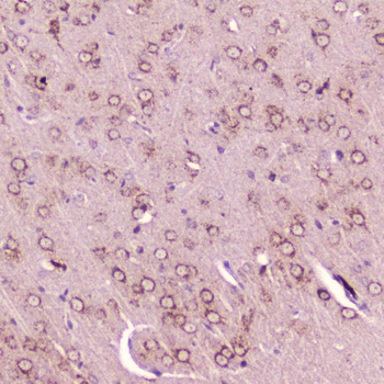 Calcitonin/Calca Rabbit Polyclonal Antibody