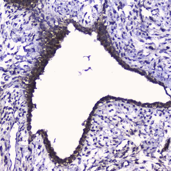 Cdk6 Rabbit Polyclonal Antibody