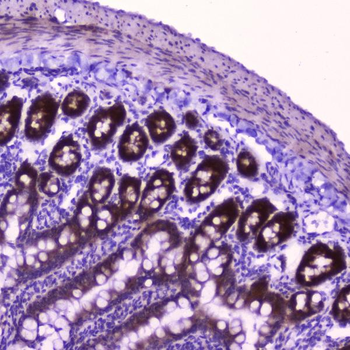 FLIP/CFLAR Antibody