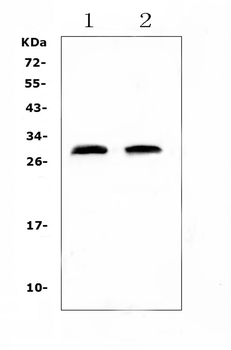 C Reactive Protein/Crp Antibody