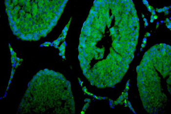 Cytochrome P450 17A1/Cyp17a1 Antibody