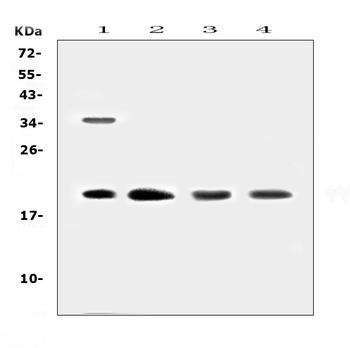 Dermatopontin/DPT Rabbit Polyclonal Antibody