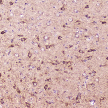IGFBP2 Antibody