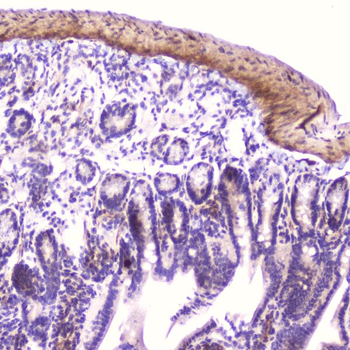 IGFBP2 Antibody