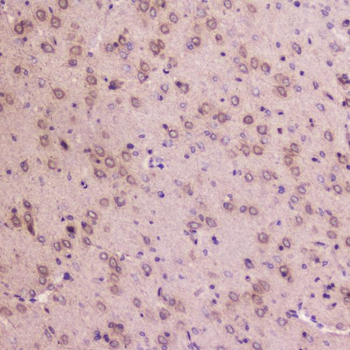 IGFBP2 Antibody