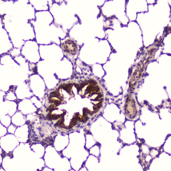 IGFBP2 Antibody