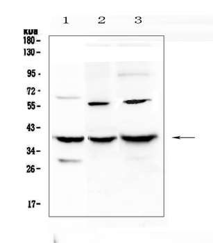 IGFBP2 Antibody