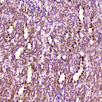 Leptin Rabbit Polyclonal Antibody