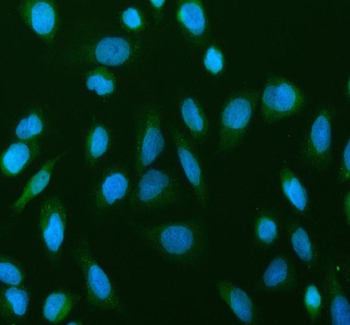 NF-kB p65/RELA/NF Rabbit Polyclonal Antibody