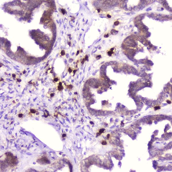 Ribonuclease 3/RNASE3 Rabbit Polyclonal Antibody
