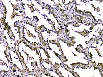 TGF beta 2/TGFB2 Rabbit Polyclonal Antibody