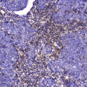 Talin 1/TLN1 Antibody
