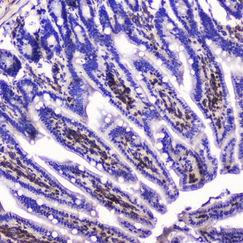 Talin 1/TLN1 Antibody