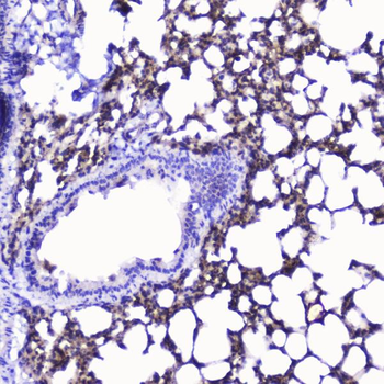 Talin 1/TLN1 Antibody