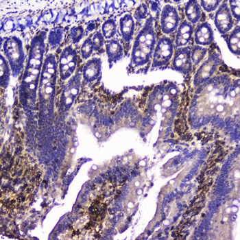 Talin 1/TLN1 Antibody